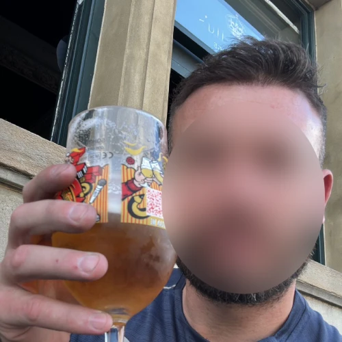 After hair transplant