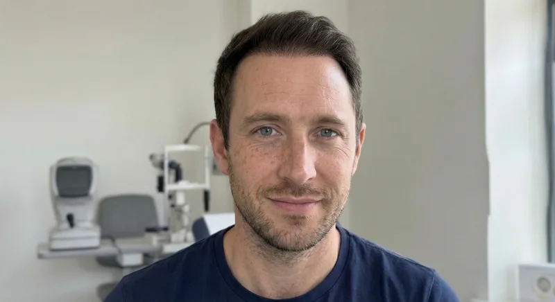 James, 32, six months after FUE hair transplant